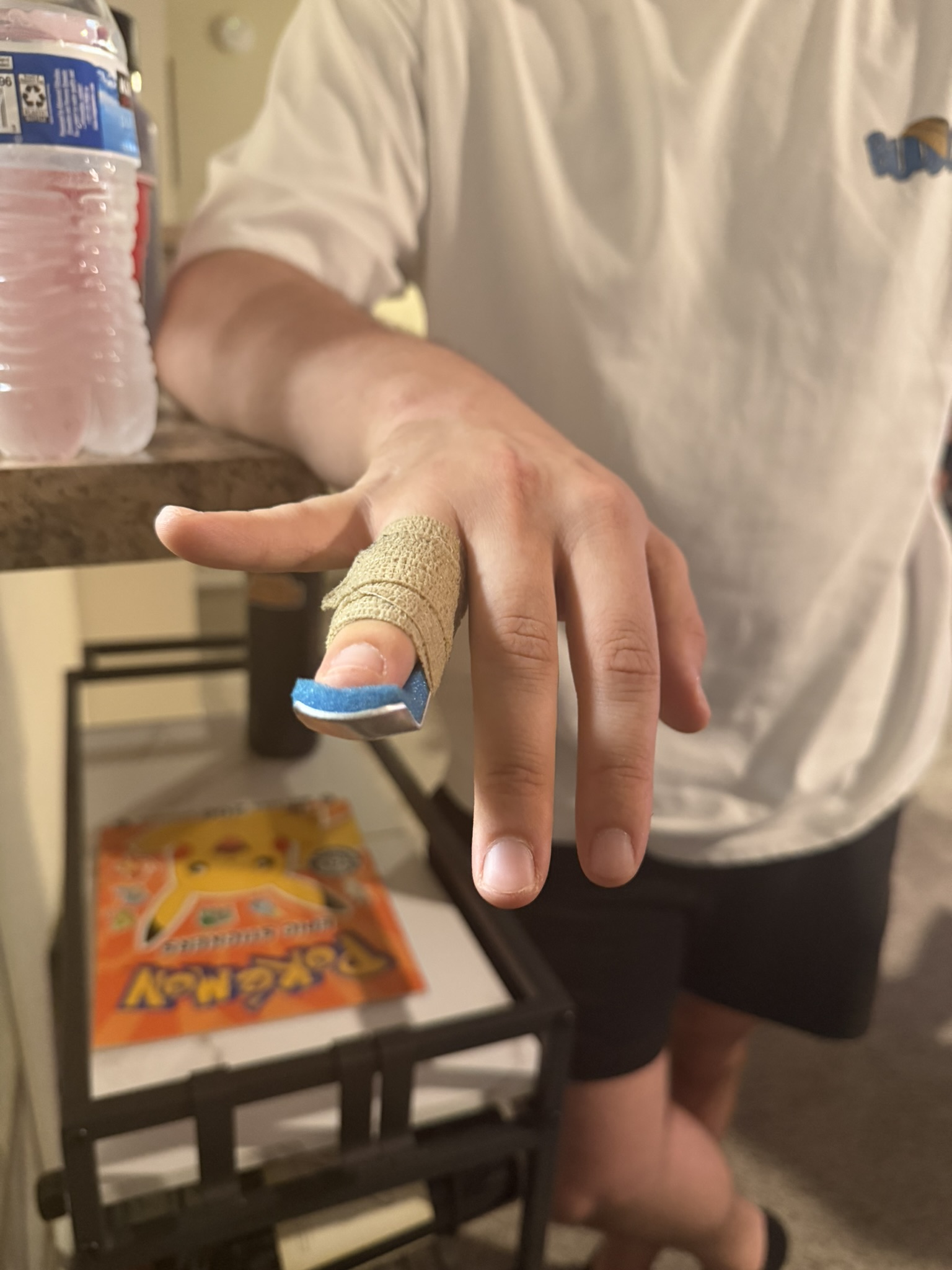Tristan's injured finger.
